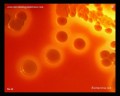 escherichia coli